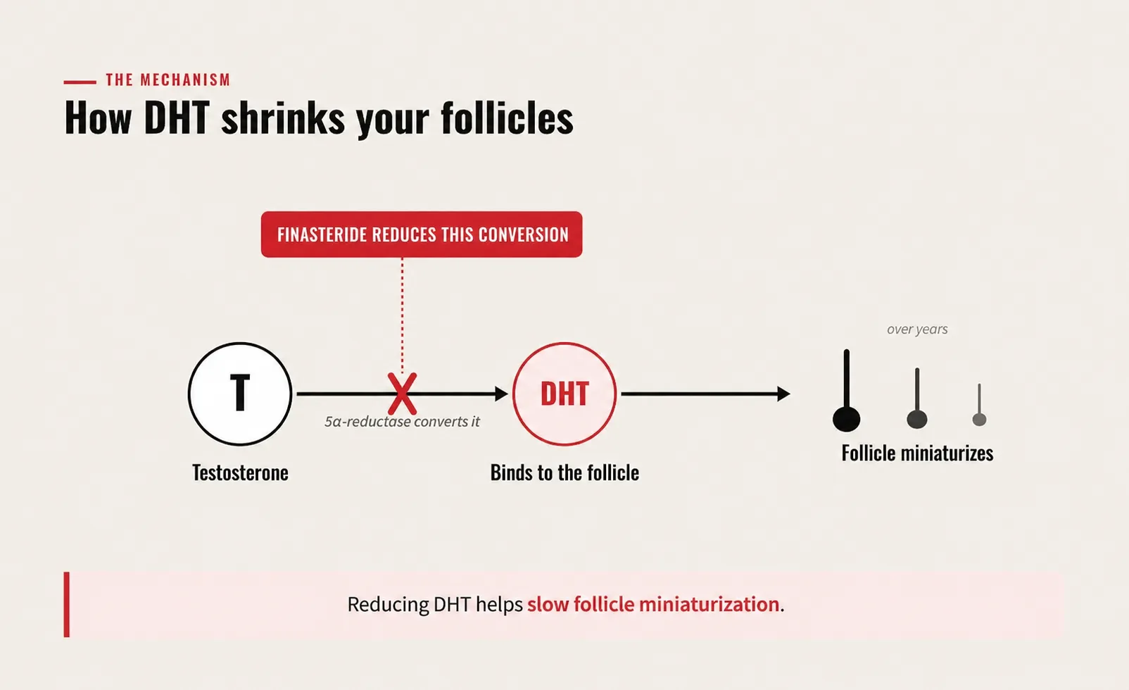 How finasteride reduces the conversion of testosterone to DHT and helps slow follicle miniaturization.